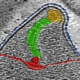 MG - Electron Microscopy