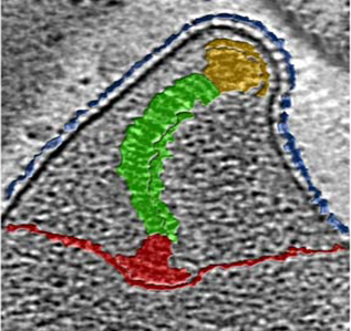 MG - Electron Microscopy