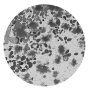 Mycoplasma Homonis
